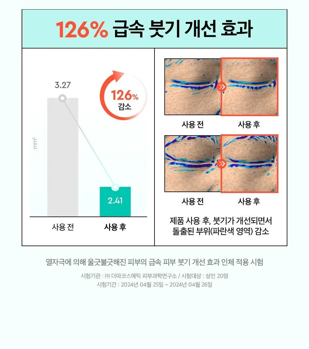 [대용량] 듀이트리 픽앤퀵 뜯어쓰는 더블 패드 100매 (화장발/카밍풀/모공탄력/비타광채) 상세페이지 44